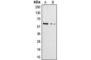 Western blot analysis of Cytochrome P450 3A4/5 expression in NCIH460 (A), HepG2 (B) whole cell lysates. (Cytochrome P450 3A4, 3A5 (Center) Antikörper)