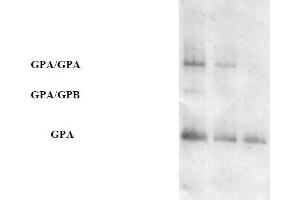 Western blot analysis using AP31671PU-N (Purified Anti-Glycophorin A pAb) at a dilution of 1/100 on human RBCs at various concentrations (GPA = Glycophorin A, GPB = Glycophorin B). (CD235a/GYPA Antikörper)