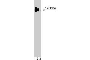 Western blot analysis of p120 Catenin on a A431 cell lysate (Human epithelial carcinoma, ATCC CRL-1555). (HNRNPU Antikörper  (AA 326-632))