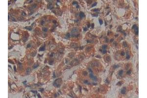 Immunohistochemistry (IHC) image for anti-Proteinase 3 (PRTN3) (AA 71-247) antibody (ABIN7433627)