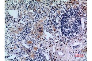 Immunohistochemistry (IHC) analysis of paraffin-embedded Human Lung, antibody was diluted at 1:100. (Transferrin Receptor Antikörper  (N-Term))