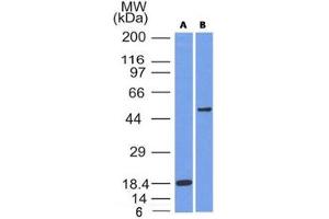 Western blot testing of A) partial recombinant protein B) A375 cell lysate using SOX10 antibody (SOX10/991). (SOX10 Antikörper  (AA 115-269))