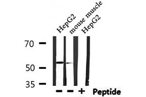 Western blot analysis of extracts from HepG2,mouse muscle, using IKZF1 Antibody. (IKZF1 Antikörper  (Internal Region))