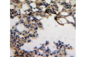 Used in DAB staining on fromalin fixed paraffin-embedded Lung tissue (CCL18 Antikörper  (AA 21-89))