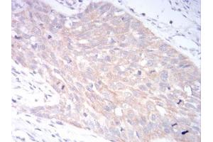 Immunohistochemistry (IHC) image for anti-Low Density Lipoprotein Receptor-Related Protein 1 (LRP1) (AA 20-155) antibody (ABIN5542496)
