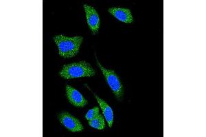 Confocal immunofluorescent analysis of D Kinase 1 (DK1) Antibody (C-term) 7217b with A549 cell followed by Alexa Fluor® 489-conjugated goat anti-rabbit lgG (green). (DAP Kinase 1 Antikörper  (C-Term))