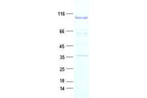 Western Blotting (WB) image for Discoidin Domain Receptor tyrosine Kinase 1 (DDR1) protein (DYKDDDDK Tag) (ABIN5505617)