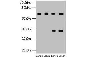 Western blot All lanes: PGM1 antibody at 6 μg/mL Lane 1: U251 whole cell lysate Lane 2: U937 whole cell lysate Lane 3: Jurkat whole cell lysate Lane 4: Hela whole cell lysate Secondary Goat polyclonal to rabbit IgG at 1/10000 dilution Predicted band size: 62, 64, 41 kDa Observed band size: 62 kDa (Phosphoglucomutase 1 Antikörper  (AA 1-562))