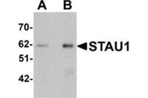 Western blot analysis of STAU1 in rat brain tissue lysate with STAU1 antibody at (A) 1 and (B) 2 μg/ml. (STAU1/Staufen Antikörper  (C-Term))