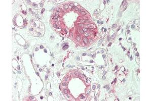 Human Kidney: Formalin-Fixed, Paraffin-Embedded (FFPE) (MICAL1 Antikörper)