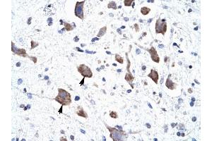 CLCN3 antibody was used for immunohistochemistry at a concentration of 4-8 ug/ml to stain Neural cells (arrows) in Human Brain.