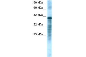 WB Suggested Anti-PSMC3 Antibody Titration:  1.