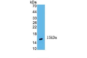 Detection of Recombinant INHbA, Human using Monoclonal Antibody to Inhibin Beta A (INHbA) (INHBA Antikörper  (AA 311-426))