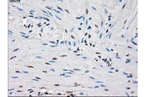 Immunohistochemical staining of paraffin-embedded endometrium tissue using anti-IDH1 mouse monoclonal antibody.