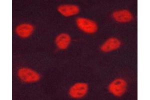 ABIN6267678 staining HUVEC cells by ICC/IF. (ESR2 Antikörper  (pSer105))