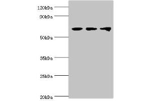 Western blot All lanes: Probable ATP-dependent RNA helicase DDX5 antibody at 3 μg/mL Lane 1: NIH/3T3 whole cell lysate Lane 2: Hela whole cell lysate Lane 3: 293T whole cell lysate Secondary Goat polyclonal to rabbit IgG at 1/10000 dilution Predicted band size: 70, 61 kDa Observed band size: 70 kDa (DDX5 Antikörper  (AA 1-290))