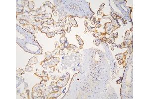IHC analysis of cortactin using anti-cortactin antibody (ABIN6719306).