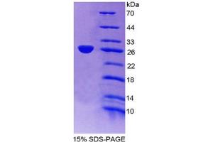 SDS-PAGE analysis of Mouse Apolipoprotein A4 Protein. (APOA4 Protein)