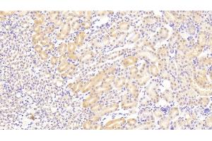 Detection of VCL in Mouse Kidney Tissue using Polyclonal Antibody to Vinculin (VCL) (Vinculin Antikörper  (AA 879-1064))