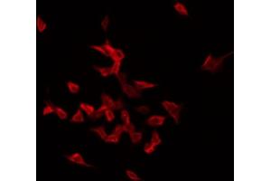 ABIN6272428 staining Hela by IF/ICC. (Septin 1 Antikörper  (Internal Region))