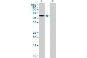 Western Blot analysis of ERCC6L expression in transfected 293T cell line by ERCC6L MaxPab polyclonal antibody. (ERCC6L Antikörper  (AA 1-419))