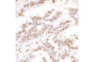 Immunohistochemistry (IHC) image for anti-H2A Histone Family, Member X (H2AFX) (C-Term) antibody (ABIN7453533)