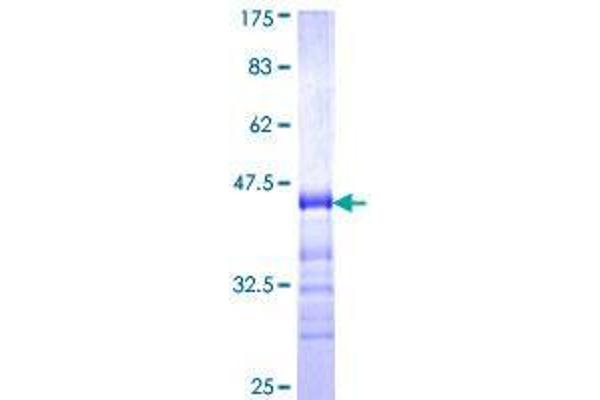 TJP3 Protein (AA 868-952) (GST tag)