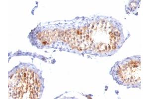 Formalin-fixed, paraffin-embedded human Testis stained with MART-1 / Melan-A Monoclonal Antibody (A103+M2-7C10+M2-9E3). (MLANA Antikörper)