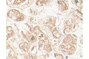 Immunohistochemical staining of formalin-fixed paraffin-embedded human fetal liver tissue showing membrane staining with AGPS polyclonal antibody  at 1 : 100 dilution. (AGPS Antikörper  (AA 462-632))