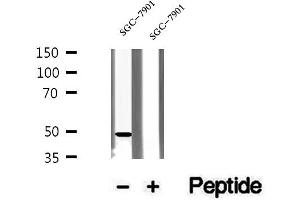Western blot analysis of extracts of SGC-7901 cells, using UQCRC2 antibody.
