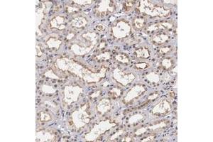 Immunohistochemical staining (Formalin-fixed paraffin-embedded sections) of human kidney with NR4A2 polyclonal antibody  shows moderate membranous and nuclear positivity in cells in tubules. (NR4A2 Antikörper)