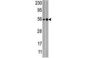 Image no. 1 for anti-60S Ribosomal Export Protein NMD3 (NMD3) (C-Term) antibody (ABIN357284)