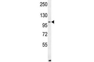 ALDH1L2 antibody  (AA 743-772)