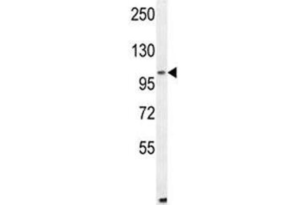 ALDH1L2 anticorps  (AA 743-772)