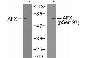 Western blot analysis of extracts from 293 cells using AFX (Ab-197) antibody (Line 1 and 2) and AFX (phospho-Ser197) antibody (Line 3 and 4). (FOXO4 Antikörper  (pSer197))