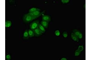 Immunofluorescent analysis of MCF-7 cells using ABIN7163605 at dilution of 1:100 and Alexa Fluor 488-congugated AffiniPure Goat Anti-Rabbit IgG(H+L) (PAFAH1B2 Antikörper  (AA 2-229))