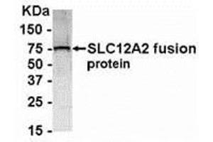 Western Blotting (WB) image for anti-Solute Carrier Family 12 (Potassium-Chloride Transporter) Member 2 (SLC12A2) (AA 800-1000) antibody (ABIN2468175) (SLC12A2 Antikörper  (AA 800-1000))