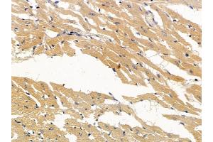 ABIN6256960 and ABIN6274918 at 1/100 staining rat heart tissue by IHC-P. (BMP10 Antikörper  (Internal Region))