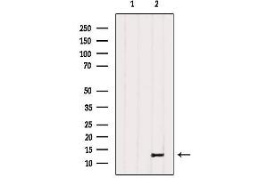 Western blot analysis of extracts from Hela, using PPP1R1C Antibody. (PPP1R1C Antikörper  (Internal Region))