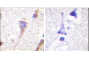 Immunohistochemistry analysis of paraffin-embedded human brain tissue, using PKD1/PKC mu (Ab-463) Antibody. (PKC mu Antikörper  (AA 429-478))