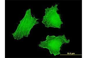 Immunofluorescence of monoclonal antibody to DLX5 on HeLa cell. (DLX5 Antikörper  (AA 1-110))