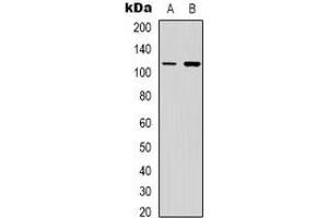 Western blot analysis of PI3K p110 gamma expression in Jurkat (A), NIH3T3 (B) whole cell lysates. (PIK3 gamma Antikörper)