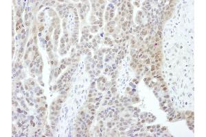 Immunohistochemistry (IHC) image for anti-Proteasome (Prosome, Macropain) 26S Subunit, Non-ATPase, 1 (PSMD1) (AA 1-50) antibody (ABIN7454975)