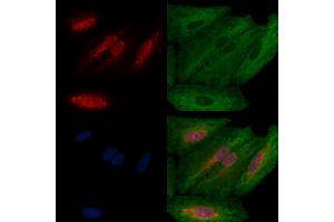 ABIN6257344 and ABIN6274221 staining  cells by IF/ICC. (MZF1 Antikörper  (N-Term))