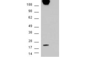 Image no. 3 for anti-Caveolin 1, Caveolae Protein, 22kDa (CAV1) (Internal Region) antibody (ABIN374578) (Caveolin-1 Antikörper  (Internal Region))