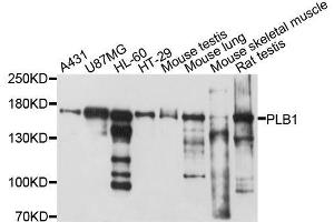 Western blot analysis of extracts of various cell lines, using PLB1 antibody. (Phospholipase B Antikörper  (AA 1110-1415))