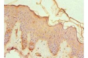Immunohistochemistry of paraffin-embedded human skin tissue using ABIN7148815 at dilution of 1:100 (CREB3 Antikörper  (AA 1-230))