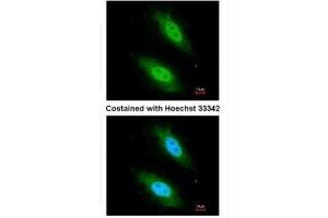 ICC/IF Image Immunofluorescence analysis of paraformaldehyde-fixed HeLa, using CARD8, antibody at 1:200 dilution. (CARD8 Antikörper  (C-Term))