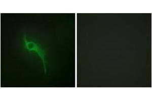 Immunofluorescence analysis of HeLa cells, using Collagen V alpha1 Antibody. (COL5A1 Antikörper  (AA 301-350))