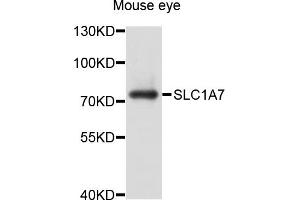 Western blot analysis of extracts of mouse eye, using SLC1A7 antibody (ABIN4905181) at 1:1000 dilution. (SLC1A7 Antikörper)